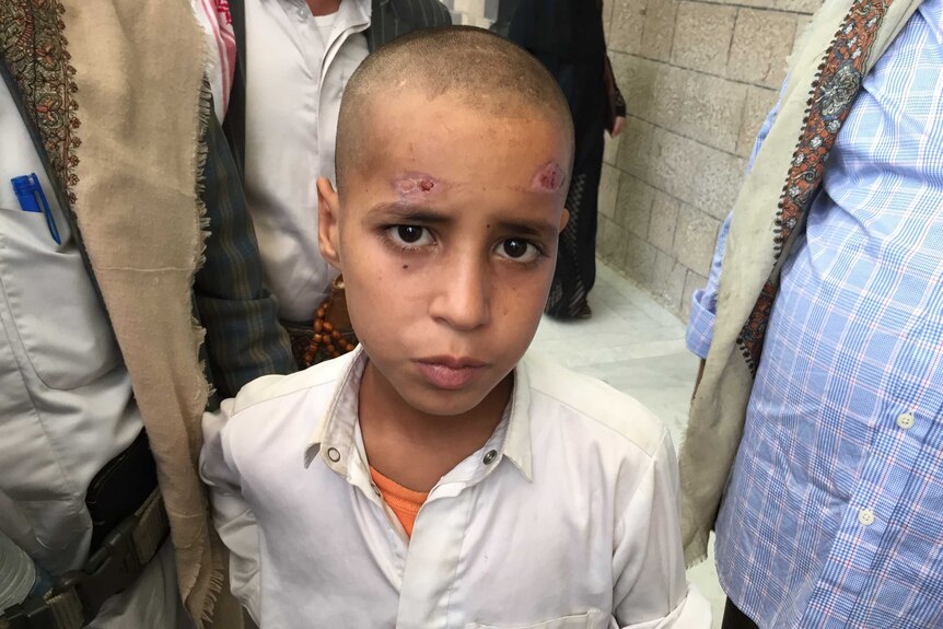 Murad, who looks around 10 years old, has healing wounds on his forehead from a cluster bomb.