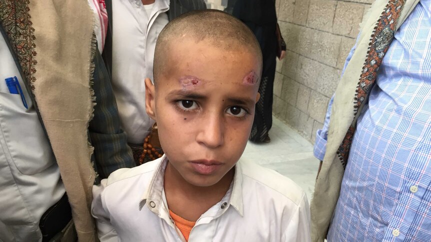 Murad, who looks around 10 years old, has healing wounds on his forehead from a cluster bomb.