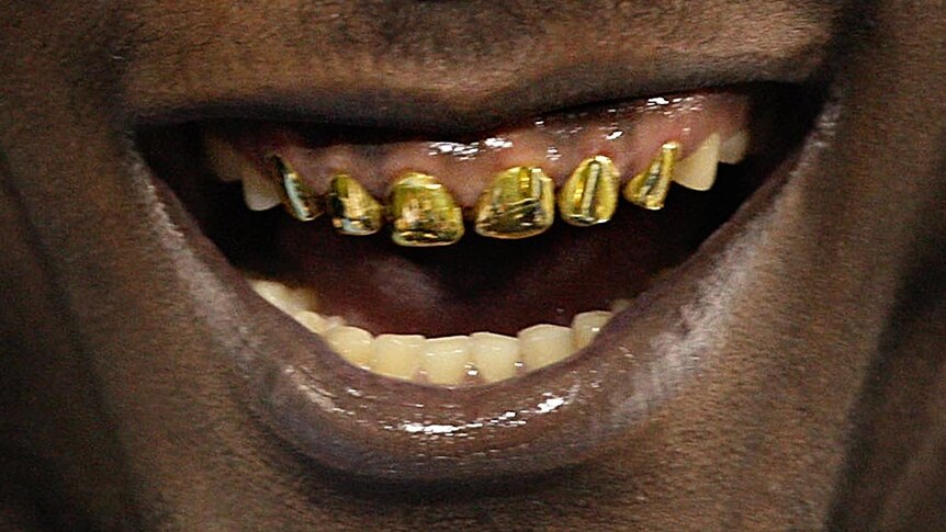 Gold teeth in a smiling mouth