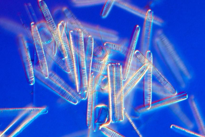 Estructuras claras similares a agujas vistas a través de un microscopio sobre un fondo azul.