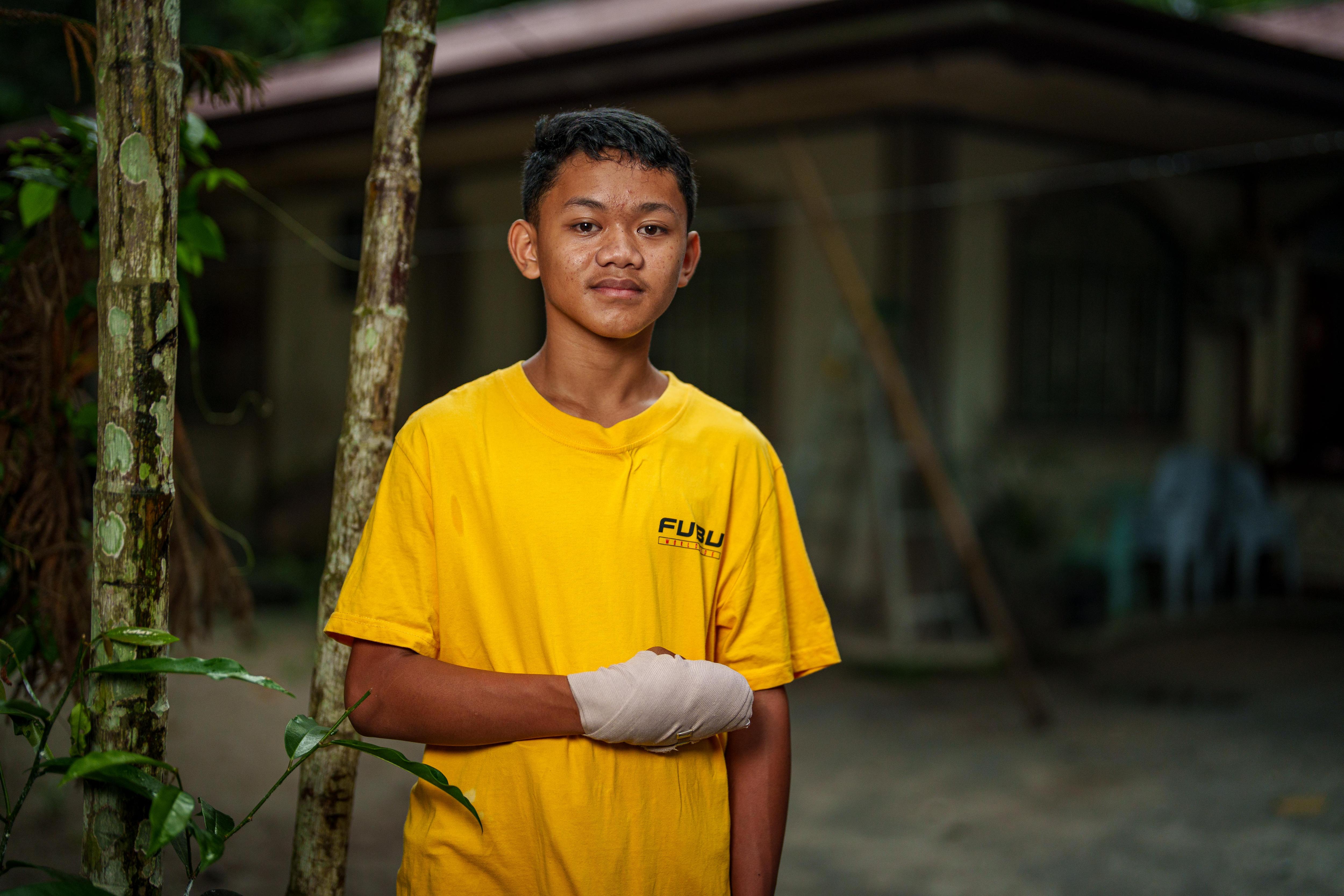 A young Filipino schoolboy wearing a yellow shirt holds his bandaged right hand at his waist.
