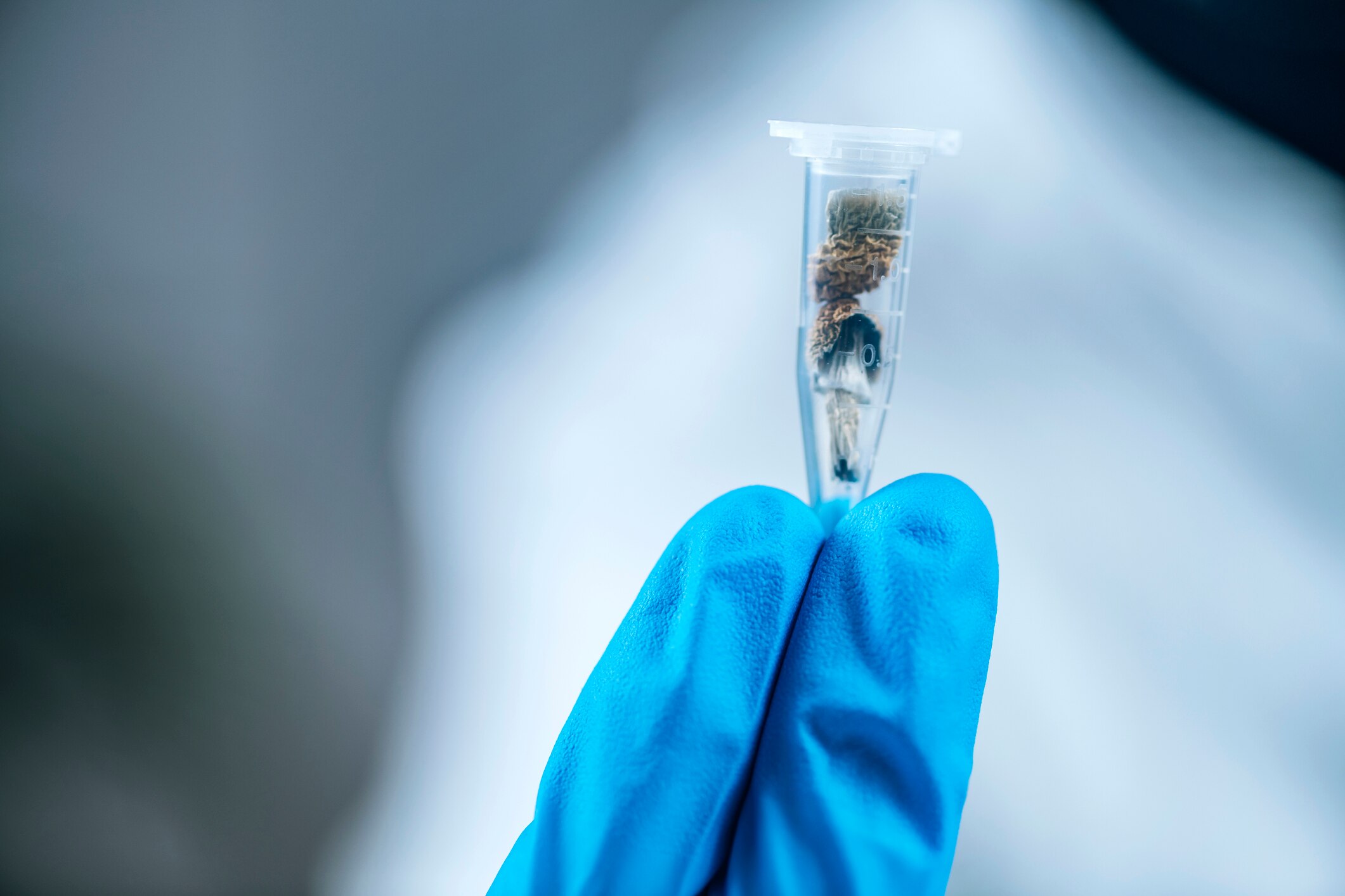 The psilocybin controversy — the promoters answer back - ABC listen