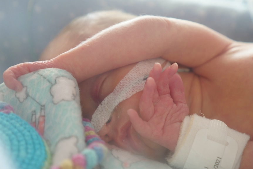 A sleeping baby, tube on face, arm holding onto blanket, little hand resting under chin.