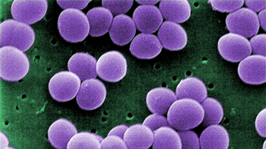 New study shows ‘alarming rates’ of antibiotic resistant bacteria on Australia’s doorstep