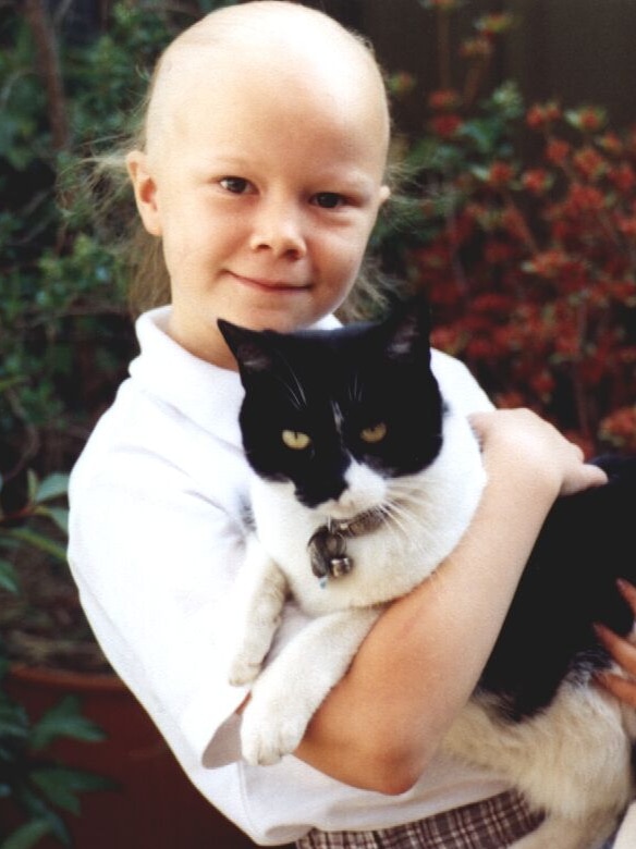 A little girl with thinning hair from alopecia holds her black and white cat