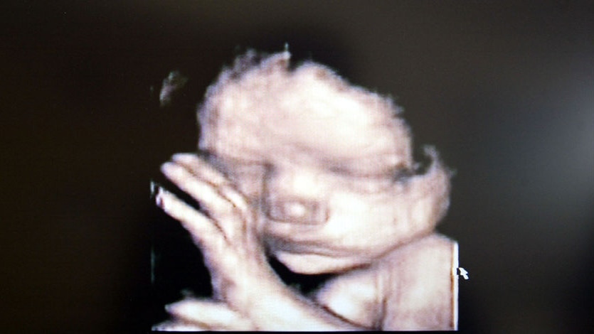 A 3D ultrasound showing a foetus inside the womb.