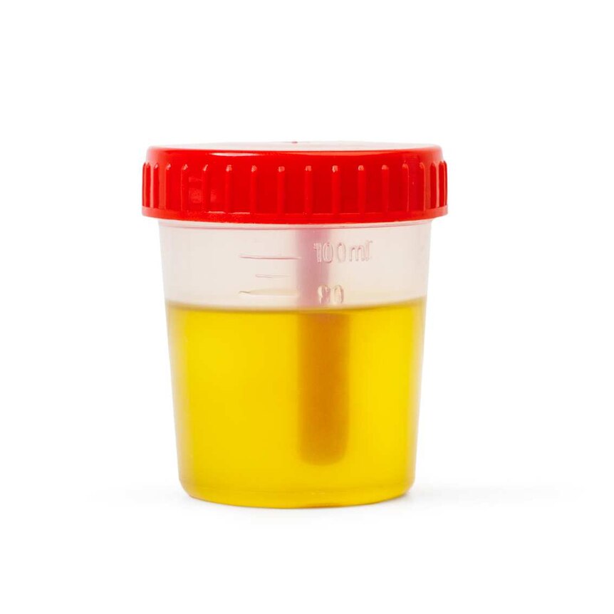 A clear plastic bottle containing a light yellow urine sample.