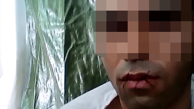 Asylum seekers on Nauru sew their lips shut