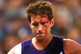 Lee Spur of the Fremantle Dockers with a cut head