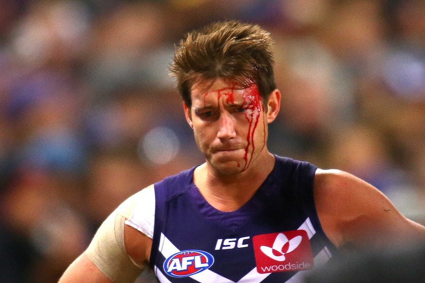Lee Spur of the Fremantle Dockers with a cut head