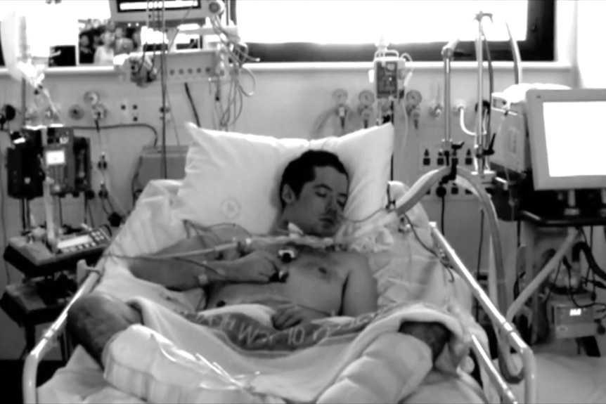 Caleb Rixon lies in a hospital bed with his eyes closed, connected to multiple tubes and machines.