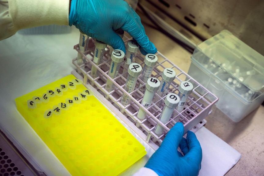 Hands wearing blue medical gloves handle 12 numbered vials. 