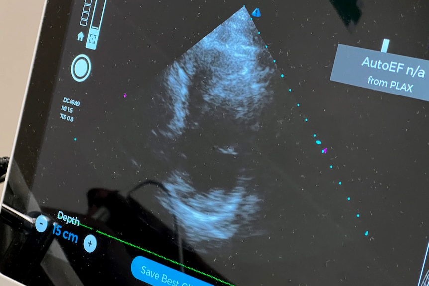 An echocardiogram image.