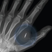 Biohacking x-ray