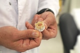 A man holds an artificial heart valve.