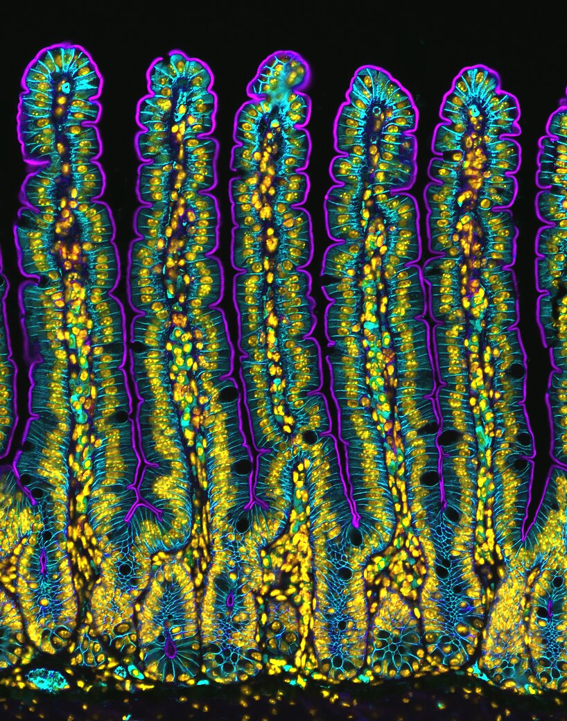 Fluro blue, green and yellow sections of a mouse's small intestine