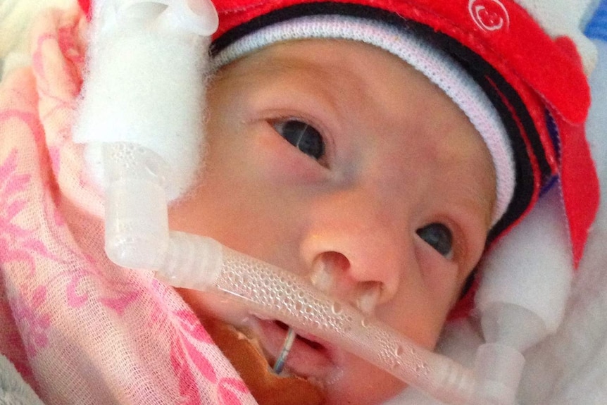 Marlowe was born 13 weeks premature and weighted only 986 grams when she was born.