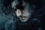 Jon Snow from Game of Thrones looking a little bloodied.