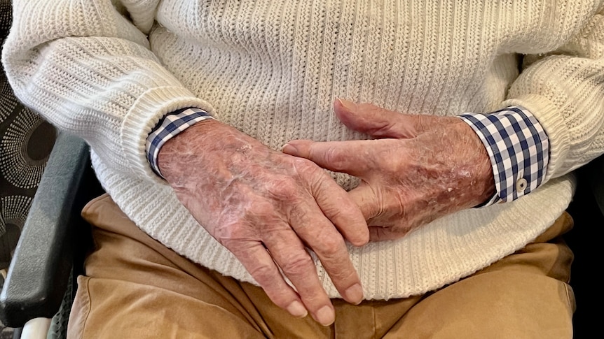 close up of the hands of an old man. he is missing the tip of his left index finger. 