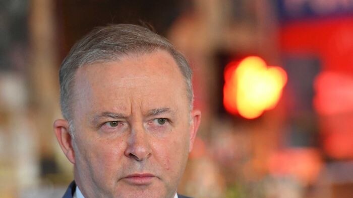 Anthony Albanese