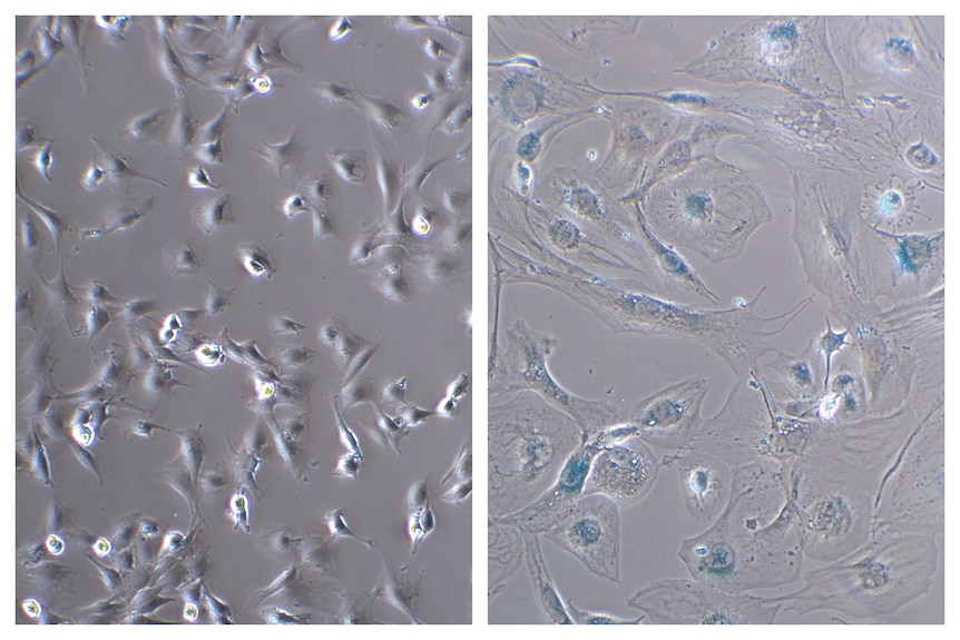Two side-by-side microscope photos show smaller, blue cells on the left, compared to larger, more spread out cells on the right.