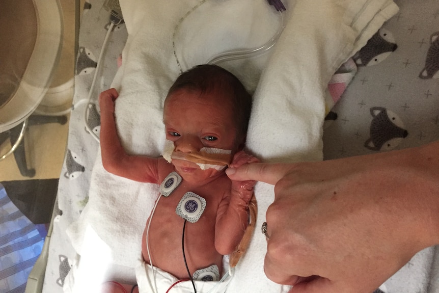 A premature baby with tubes and monitors grabs on to an adult's pinkie finger