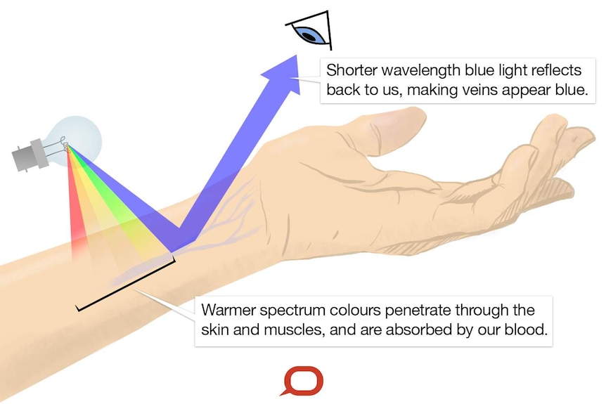A graphic showing how light affects how we see our veins.