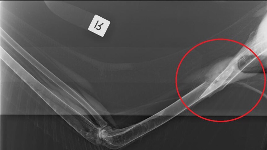 A x-ray showing a pelican's broken wing, after it was attacked at St Albans in Melbourne's north.