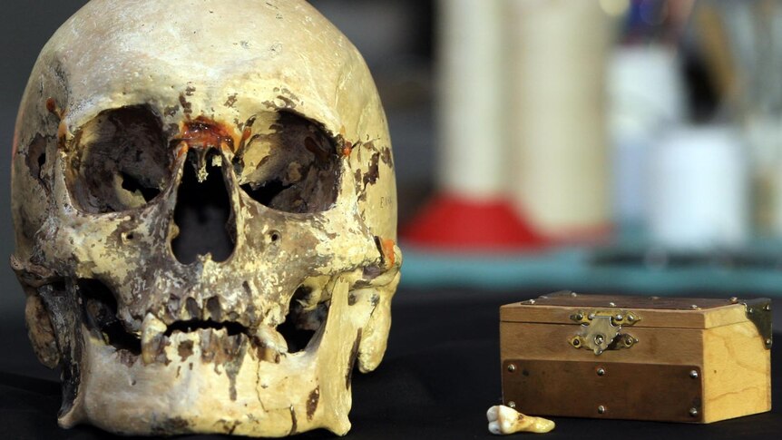 The Baxter Skull sits next to the tooth that was tested for a DNA match