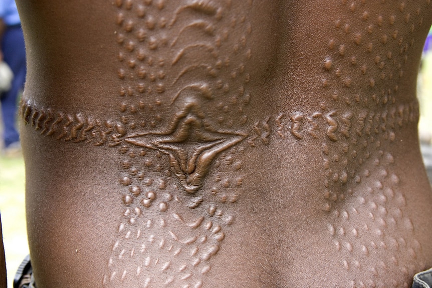 Close up of scarification on a person's back.