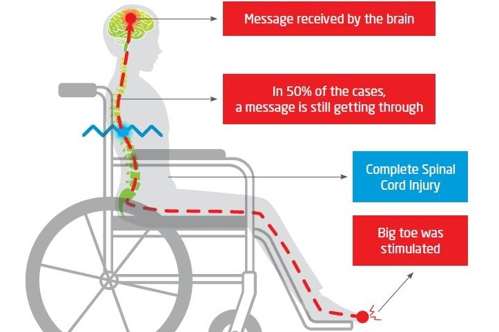 An infographic showing how messages are sent from the lower limbs to the brain.