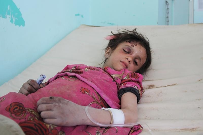 Yemen: Airstrike, injured girl