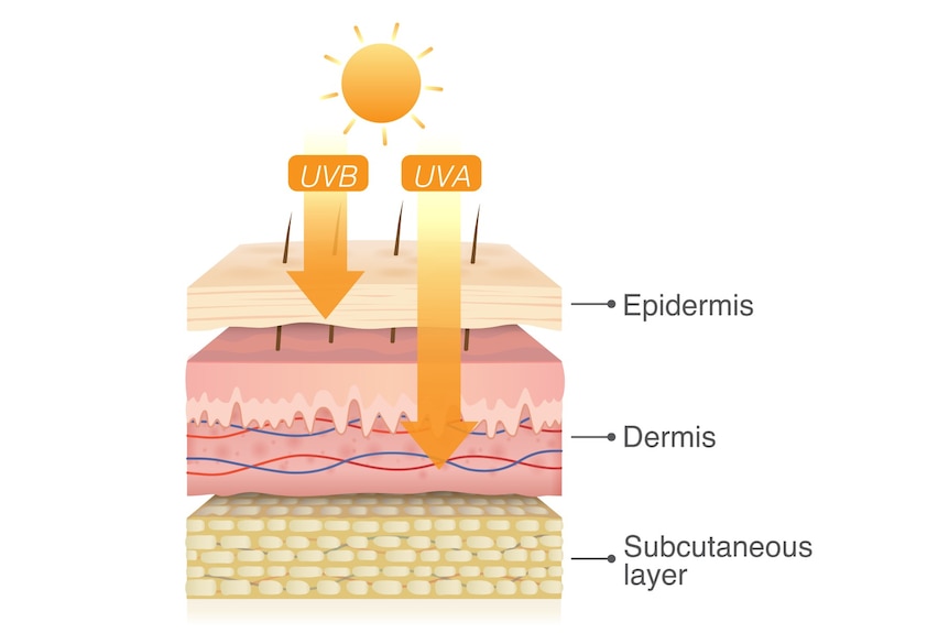A diagram showing skin layers epidermis, dermis and subcutaneous. UVB can reach the epidermis, and UVA can reach the dermis
