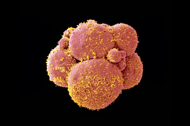 Human embryo