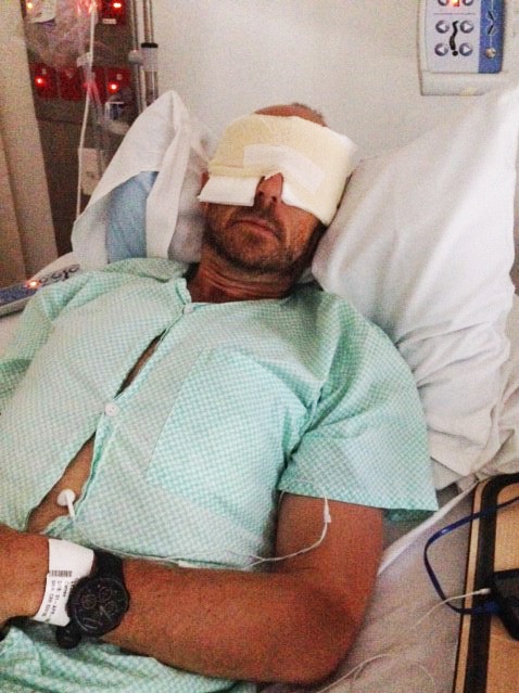 FOGGEL victim and triathlete Darren Lydeamore in hospital with eye patches.