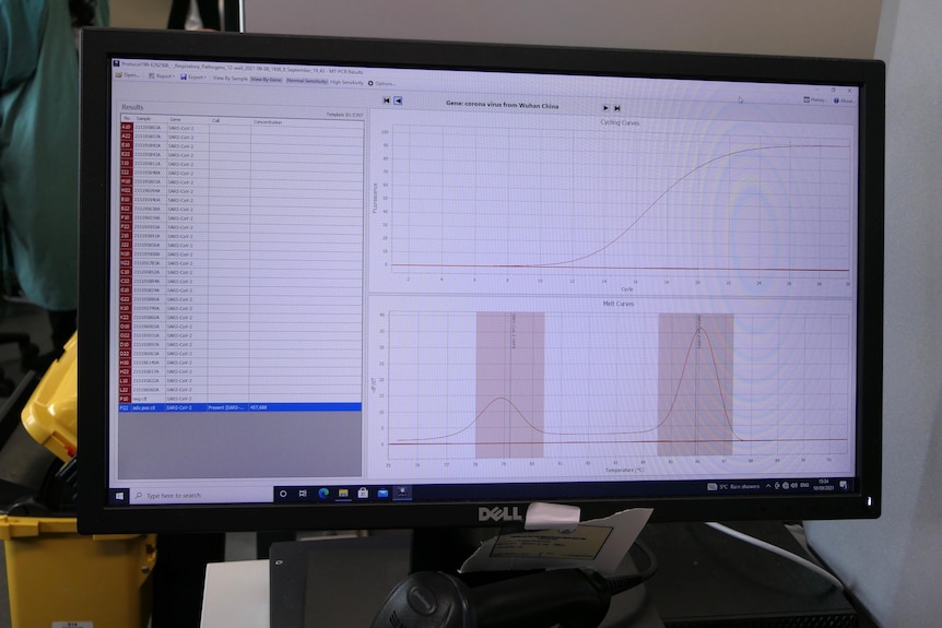 A computer screen showing the results of COVID-19 testing 