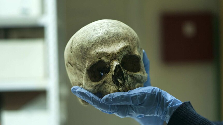 The skull of a man murdered in Srebrenica on a documenter's hand.
