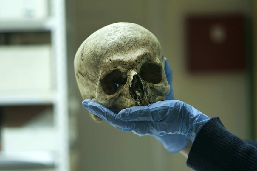 The skull of a man murdered in Srebrenica on a documenter's hand.