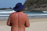 Nudist Granny - Sex pests' spark calls for nude beach relocation at Byron Bay - ABC News