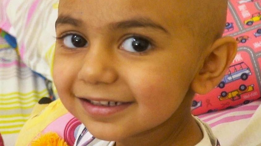 Zainab Mughal, a three year old with cancer, with a bald head