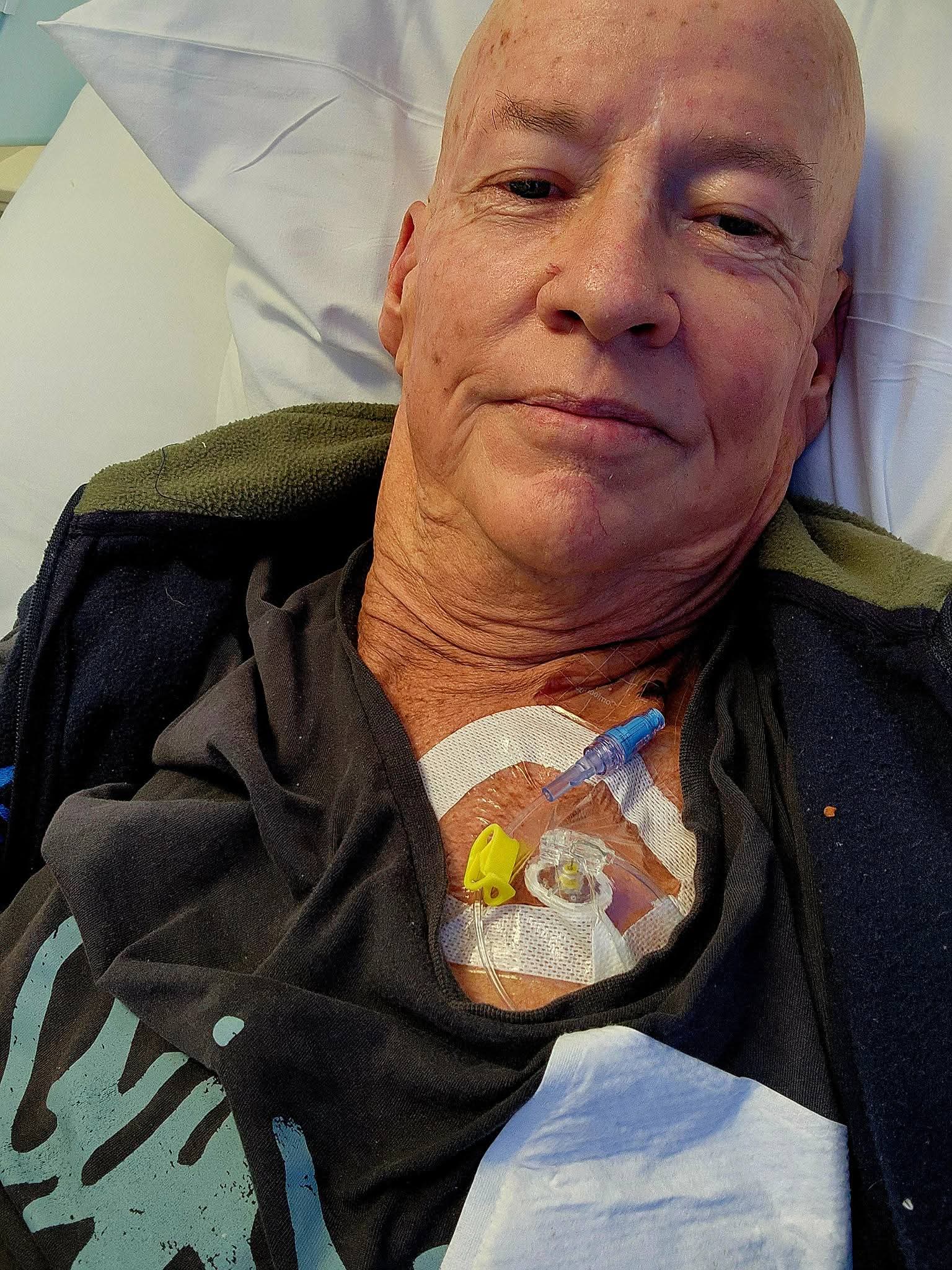 a bald man wearing a gown moved to the side to show medical equipment attached to his chest