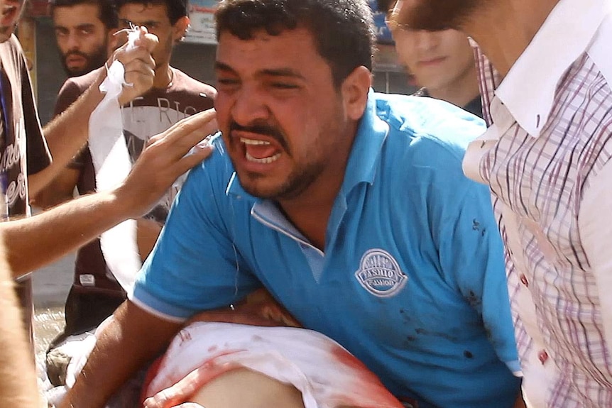 A man in a blue polo shirt cries as he holds a bandaged and bloodied child in his arms.