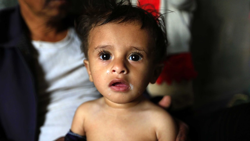 A child in Yemen