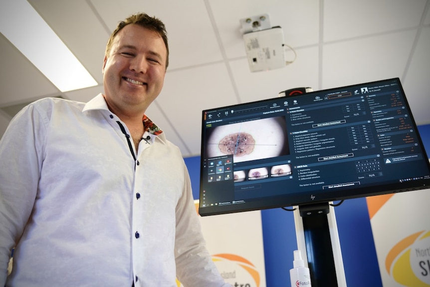 A male doctor stands in front of a medical computer screen displaying magnified melanomas.