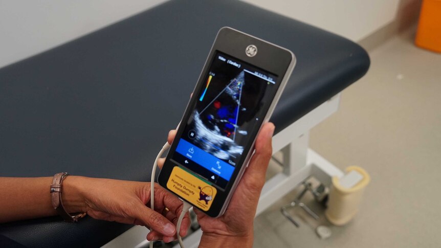 The hand-held echocardiography device known as a v-scanner.