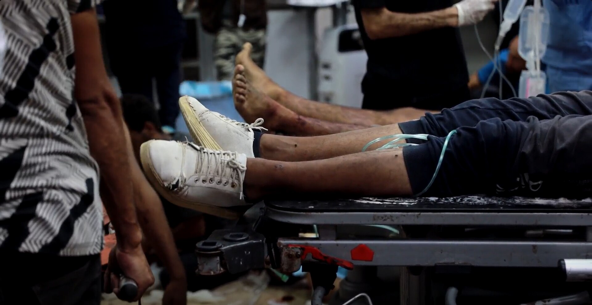 Men lying on hospital beds with only their legs visible in the shot