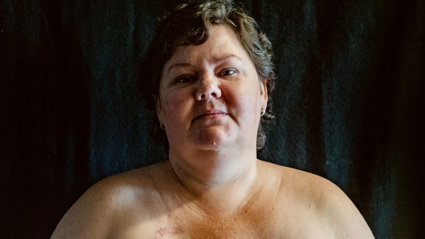 After A Mastectomy You Get New Boobs! Yay! Wait, Not Really