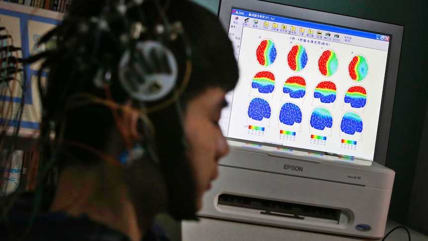 A boy has his brain scanned at an internet addiction clinic in Beijing.