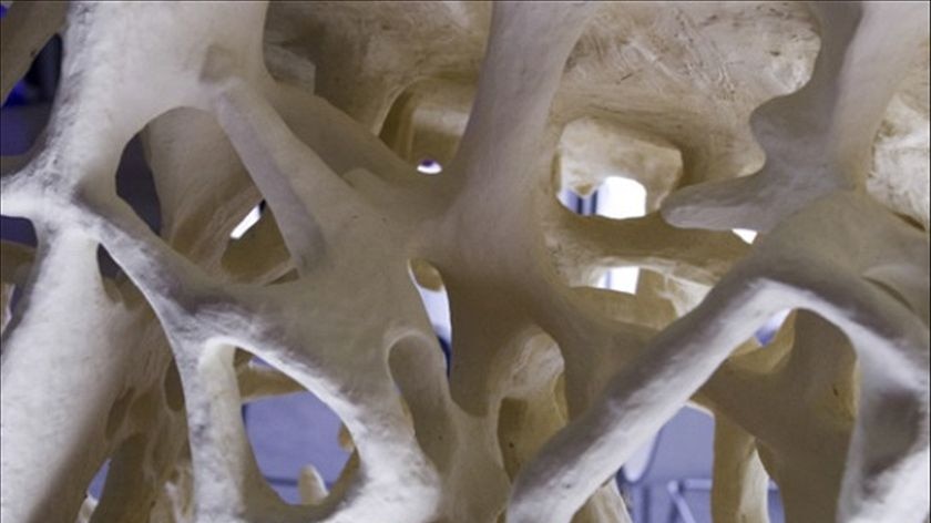 Osteoporotic bone