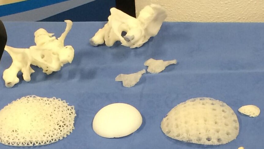 Printed scaffolds of body parts